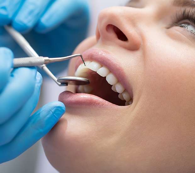 Rancho Cucamonga Dental Bonding